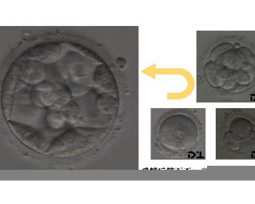 南京三大代孕公司,南京试管包性别费用贵不贵？怎样才能包性别？
