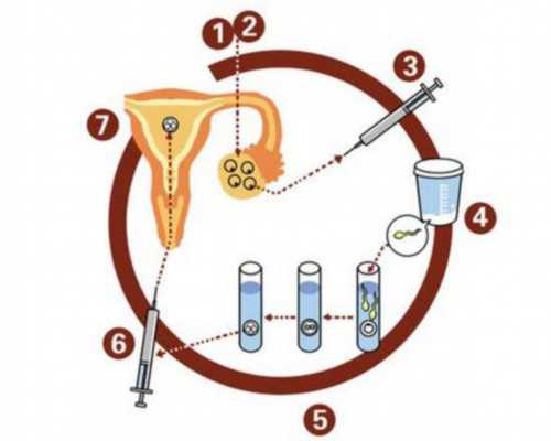 南京供卵代孕套餐,试管婴儿技术能决定男女吗-移植后胃胀胃痛-南京供卵的费用