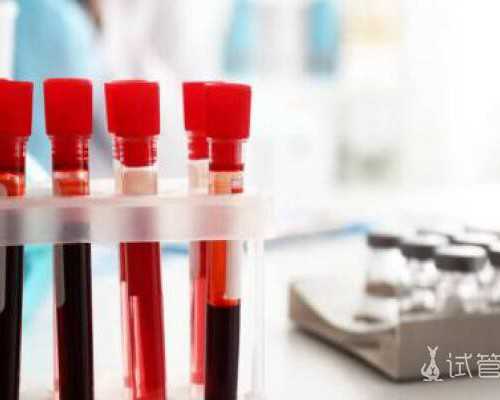 4个女性健康小常识