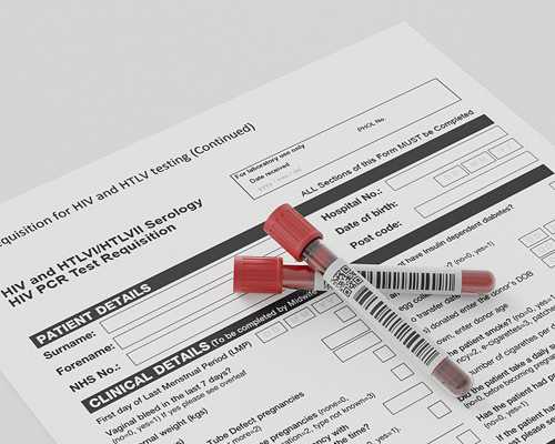 68高龄产妇试管双胞胎&怎么联系代孕,备孕杀手——弱精症有多可怕！