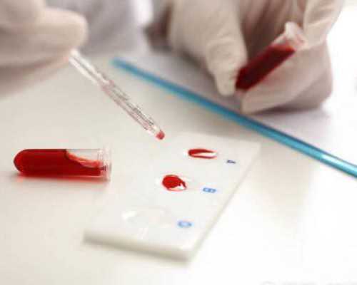 昆华做试管可以选择性别吗&供卵做无创DNA,备孕5年胎停3次需要做试管吗做试管