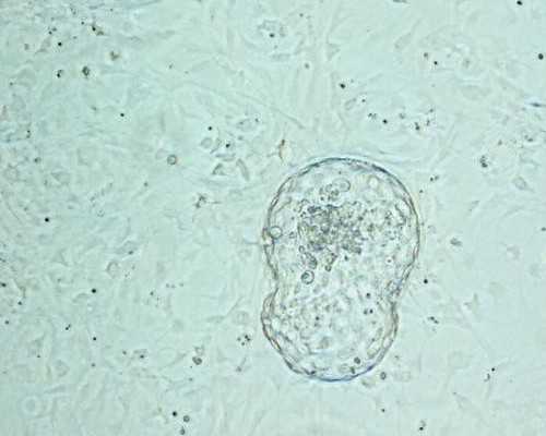 301医院试管费用多少&供卵试管包28天,孕期早餐吃什么？这有4个推荐