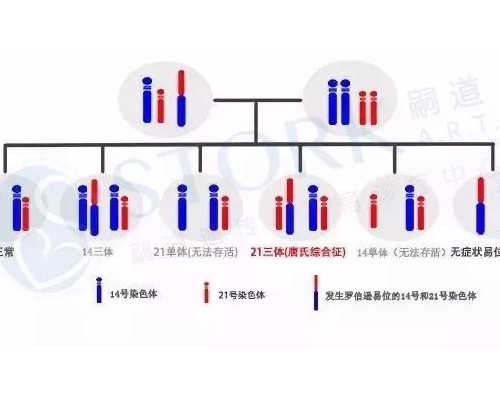 南京代怀最便宜,试管移植后能上班吗-南京供卵医院成功率-女人45岁,还能取卵成