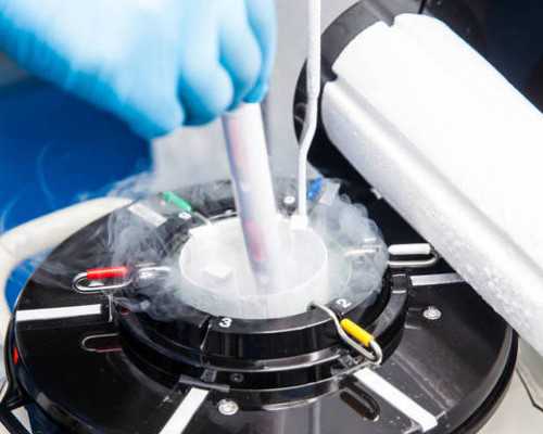 如何判断自己是不是不孕不育？有哪些检查项目？