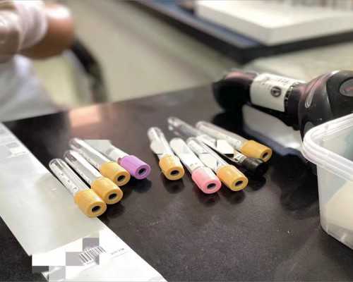 孕晚期胎位不正的原因有哪些