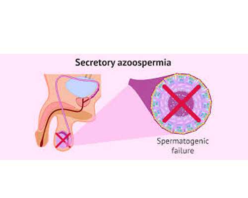 南京试管代孕医院名单,试管鲜胚移植后几天能着床？症状有哪些？-南京哪里可