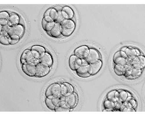孕期便秘怎么办？孕妈可以试试这些方法