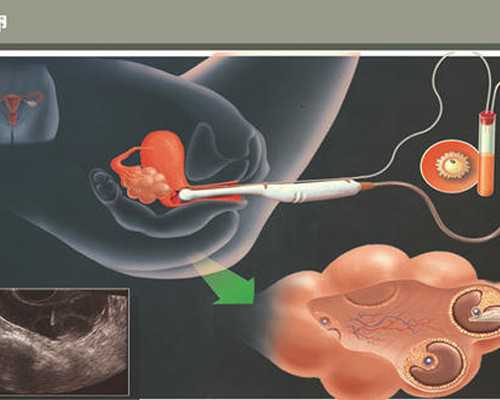 不提雨字描述雨很大怎么说 不含雨字描述雨很大的搞笑句子