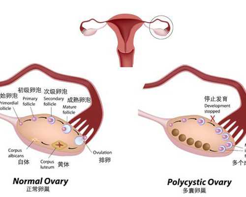 国内知名度的供卵试管&海孕供卵,2023天门不孕不育医院排名，附试管费用和成功