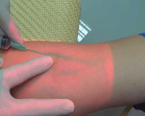 囊胚移植16天相当于怀孕几周&泰国供卵最好的医院,中医为你详解不孕不育知识