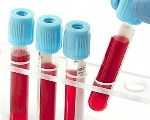 备孕二胎要做好哪些准备工作