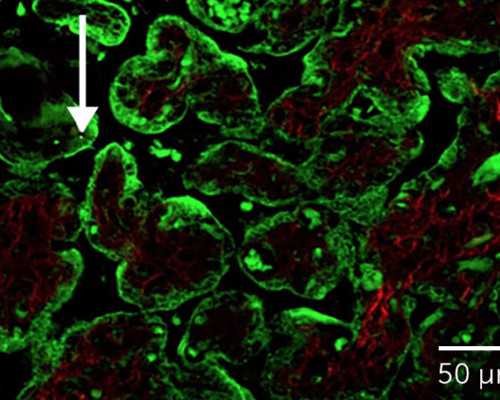 在那个国家可以合法的做代孕&供卵试管和女方血型,备孕前吃哪10种强酸性水果