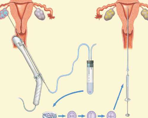 amh值低做试管成功率&有招代生的吗,孕妇不能打什么疫苗