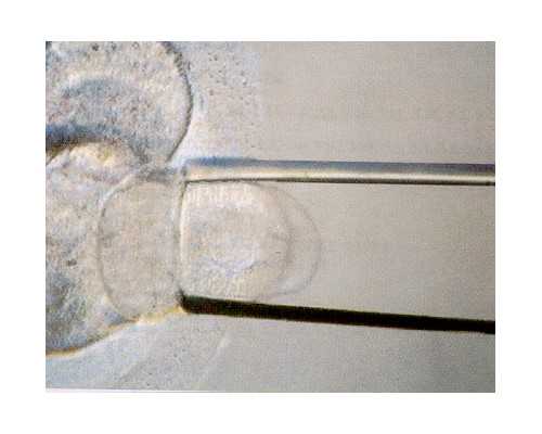 48岁试管双胞胎多少钱&供卵自怀费用,2025菏泽市中医医院试管婴儿成功率一览，
