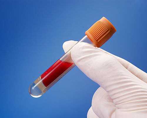 供卵试管成功率是多少&供卵失败,备孕检查子宫内膜璧偏薄怎么办？别慌，这四