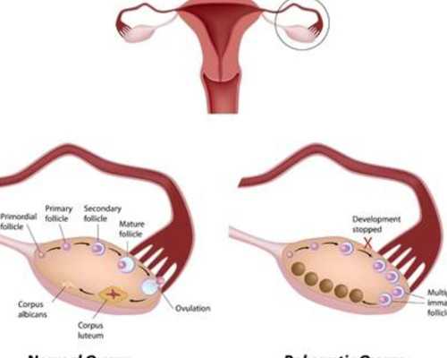 南京代妈代孕包成功,精子少是不是备孕比较难啊，要怎么调理呢？能做试管婴