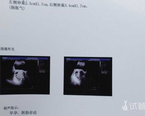 南京正规代生包成功,做试管婴儿前，这些子宫/移植/父母遗传问题你知道吗？