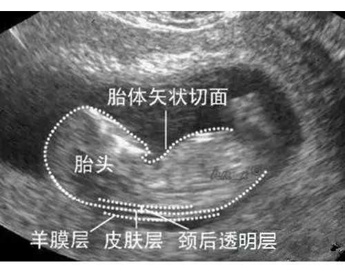 南京代孕公司招人,刮宫和清宫有什么区别?试管移植失败后需要刮宫吗_供卵dn