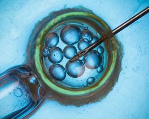 南京正规供卵机构,艾滋病人群怎么做试管婴儿-南京试管供卵价格_冷冻受精卵成