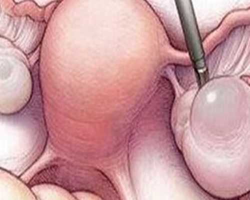 30岁做试管成功率高吗&47岁试管供卵,太瘦可能也会导致不孕不育-骨感美女4大怀