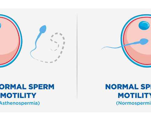 保护自己安全教案，儿歌爱护眼睛安全教案