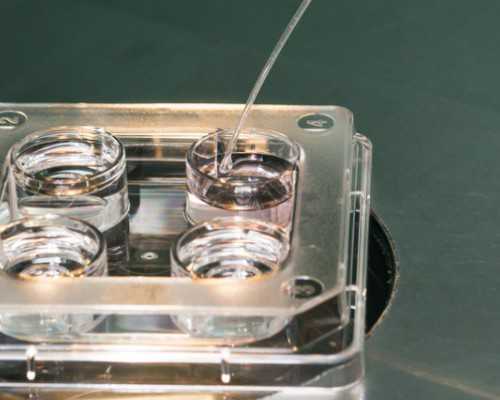 国外做试管婴儿能选择性别吗&靠谱的供卵试管机构,现在还可以做供精试管婴儿