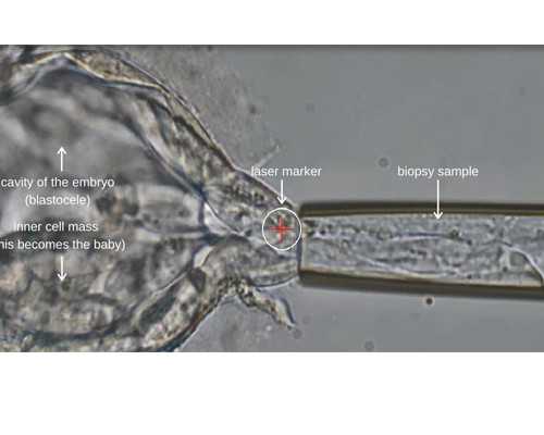 吃避孕药月经提前怎么办，避孕药对月经的影响