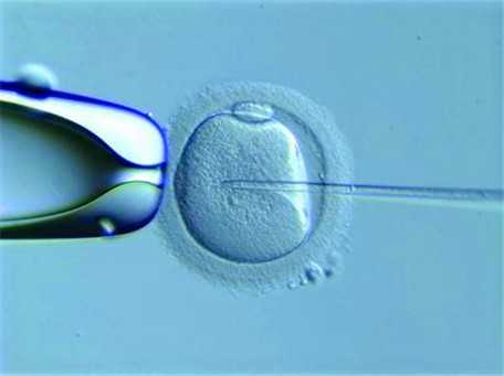 交通锥：胚胎移植后注意事项