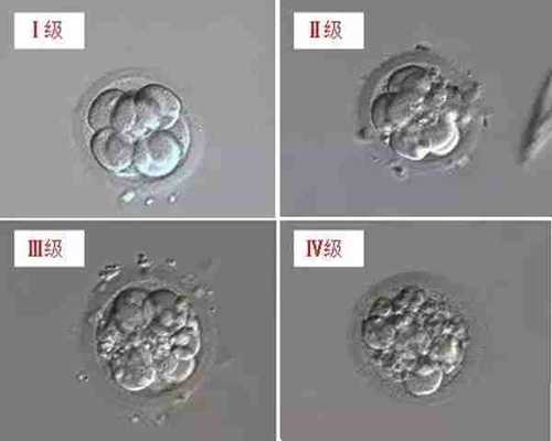 张掖试管代孕网_做试管婴儿是否要养囊？囊胚培养的好处
